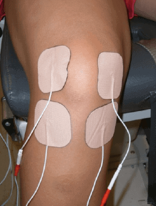 Position of the electrical muscle stimulation electrodes placed over